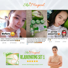Load image into Gallery viewer, Skin Magical Rejuvenating Set 1
